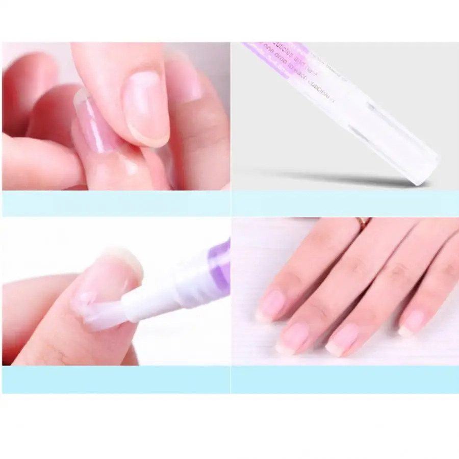 13g Nail Nutrition Oil Pen Treatment Cuticle Revitalizer Prevent Polish Nourish Skin | Красота и здоровье