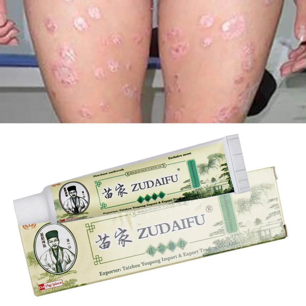 Zudaifu лечение тела псориаз крем продукт по уходу за кожей крем дерматит и экзематоидная мембрана зуд псориаз мазь