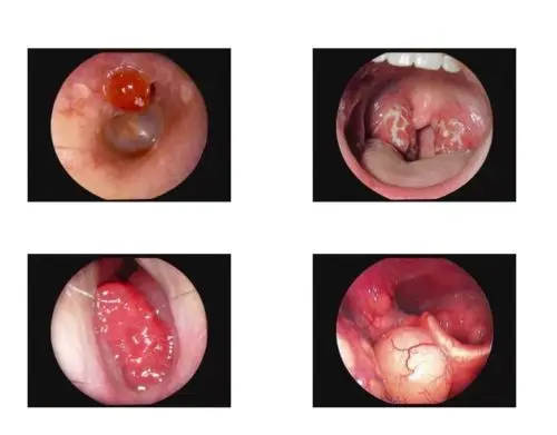 ЛОР Интраоральная Камера с 3 0 дюймов ЖК дисплей монитор|intraoral camera|camera intraoralcameras camera