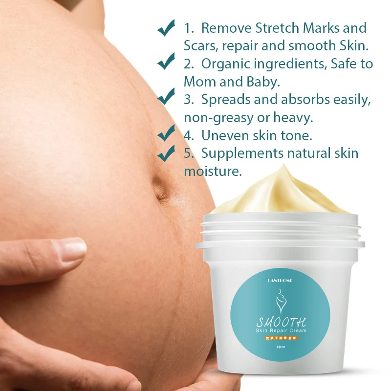 

Stretch Mark Repair Cream Lightening Pigment Brighten Skin Color Stretch Marks Remover Nourishing Skin Maternity Cream