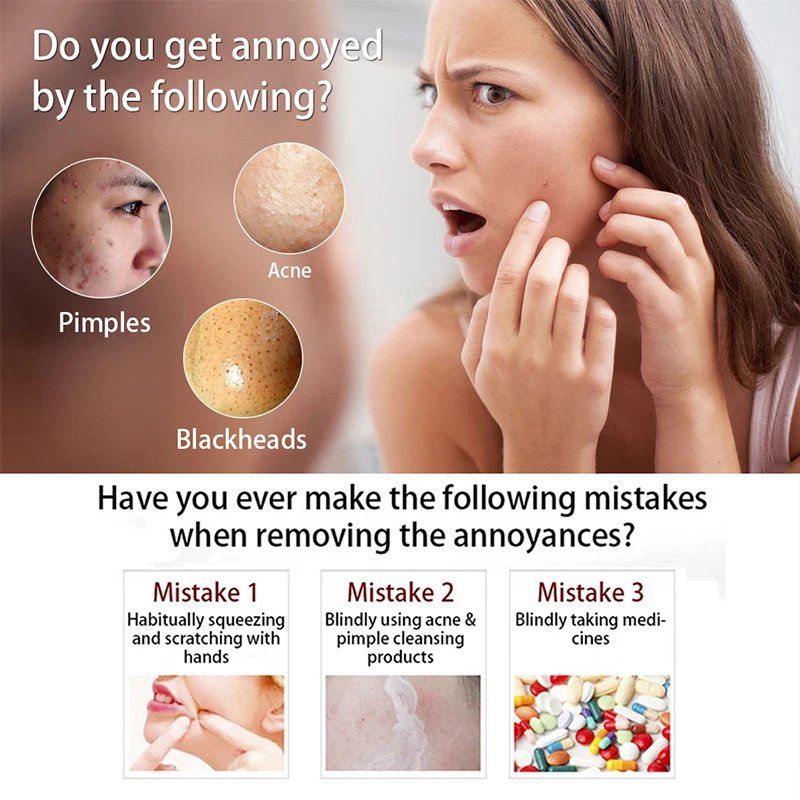 Крем для макияжа soonpure силикагель Нескользящие угри прыщи иглы экстрактор прыщей