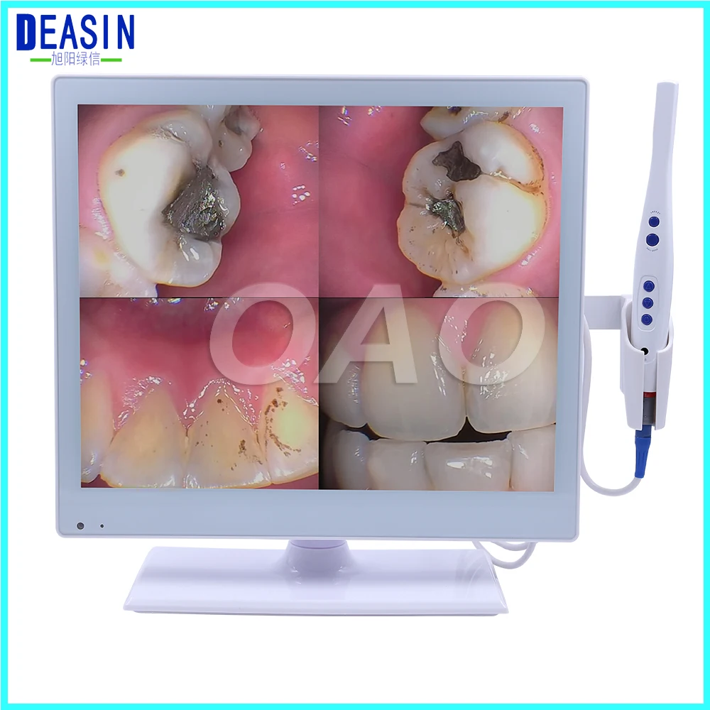 

DEASIN 17 Inch Monitor Intraoral Oral Camera with monitor USB Intraoral Camera Dental Equipment