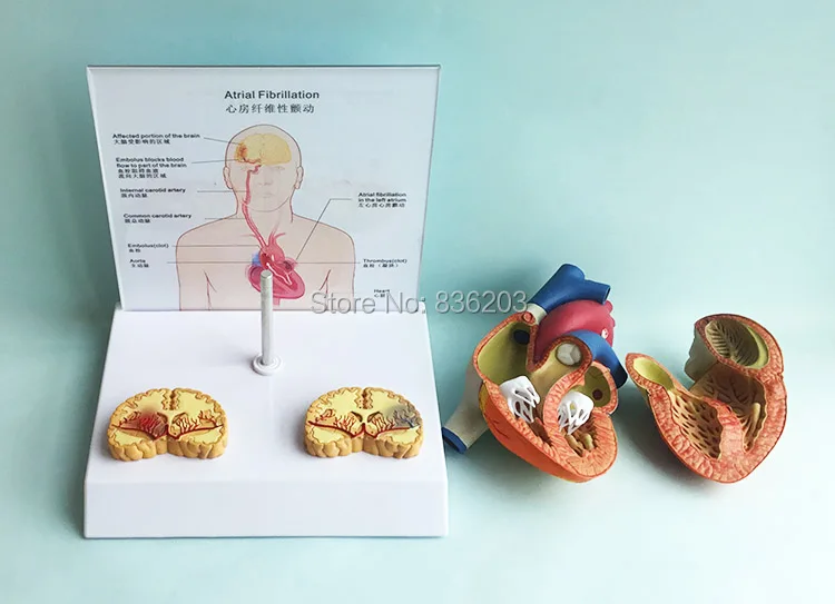 Deluxe Life size модель человеческого сердца фибрилла травматический пистолет