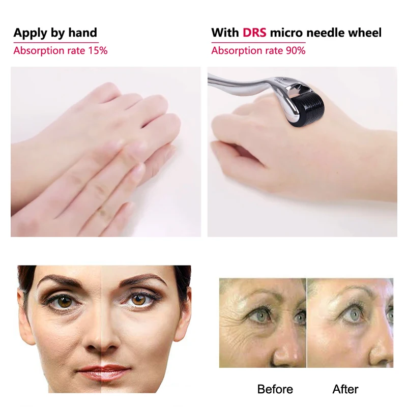 Microneedle Mezoroller DRS 540 Дерма ролик микро иглы дермароллер титановый уход за выпадением волос инструмент для ухода за кожей лица