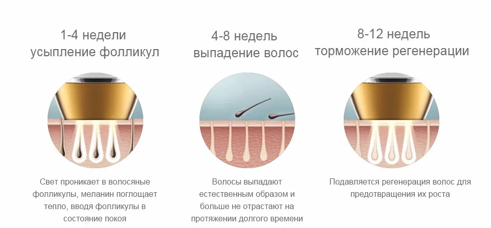 Новые 400K вспышек IPL эпилятор Постоянное удаление волос Сенсорный дисплей Депиляция Триммер бикини лазерный фотоэпилятор