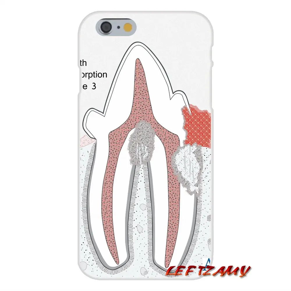 Чехлы для определения зубов для iPhone X, XR, XS, MAX, 4, 4S, 5, 5S, 5C, SE, 6, 6 S, 7, 8 Plus, ipod touch, 5, 6, аксессуары