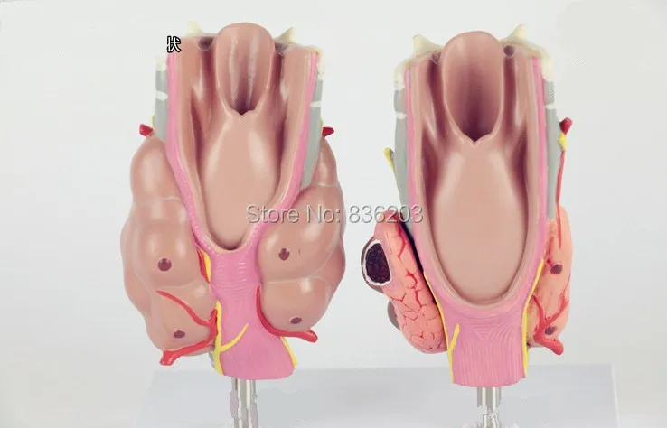 Thyroid Diseas of Human Head Neck Model in trauma anatomy skeleton dental anatomical shadow brain skullmedical training manikins |
