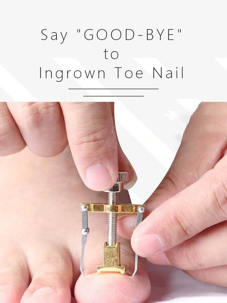 Педикюр вросший ноготь Ingrown Toe корректор для педикюра инструмент для ухода за ногами бандаж для ногтей набор машина для детоксикации Onyxis Bunion прецизионные кусачки для ног