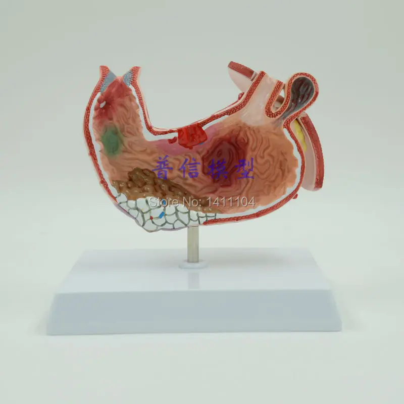 Свободная Анатомия человеческого желудка медицинские рекламные подарки