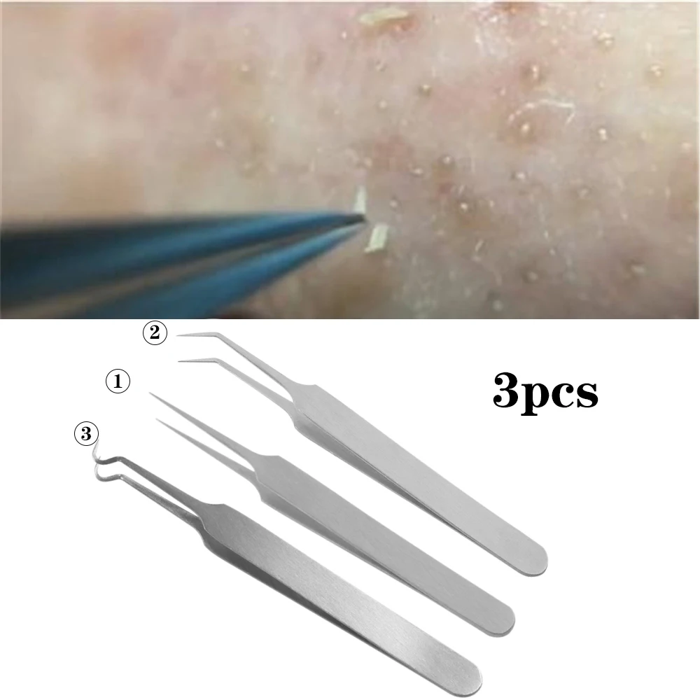 3 шт./компл. игольчатый Пинцет для прыщей чёрная голова прыщи Удаление острый