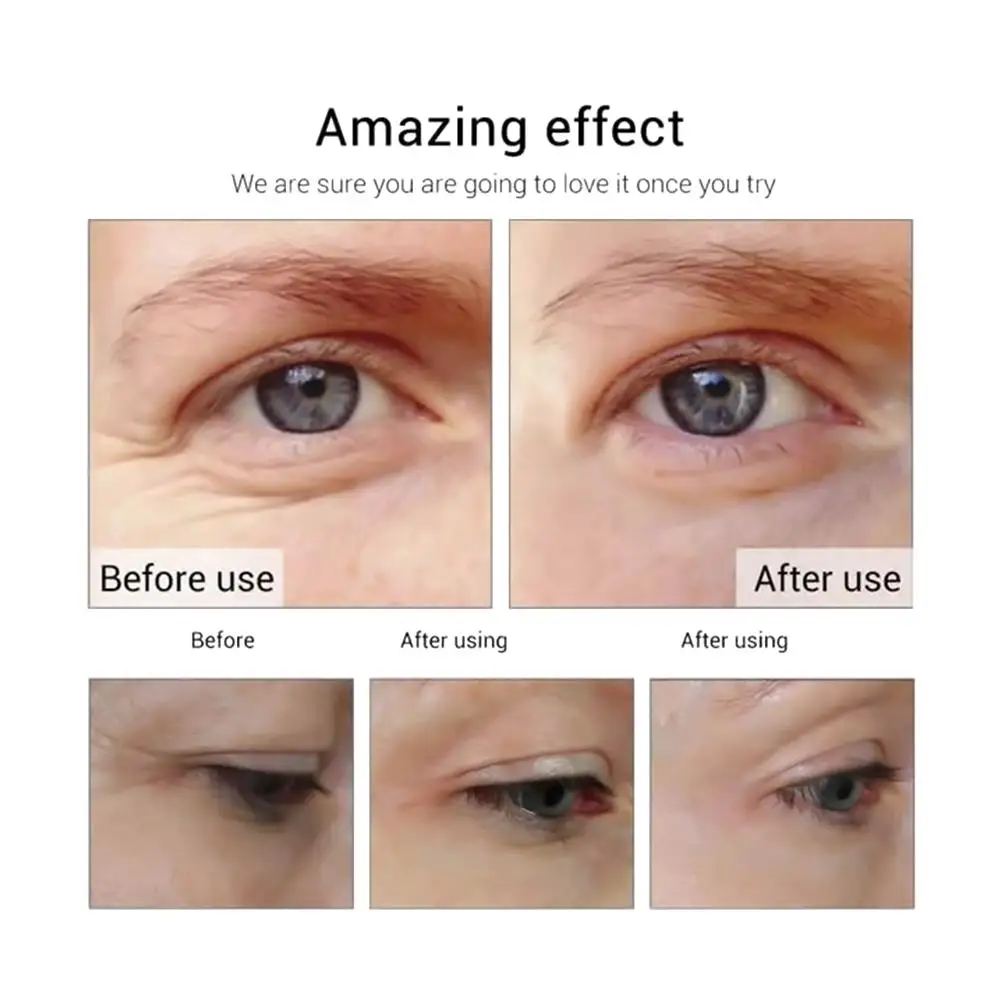 10 мл Сыворотка для глаз удаляет темные круги мешки устраняет морщинки против