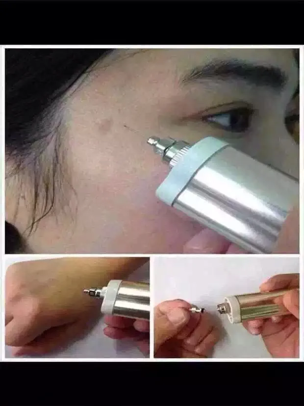 Микро токовая плазменная Косметическая ручка для удаления родинок