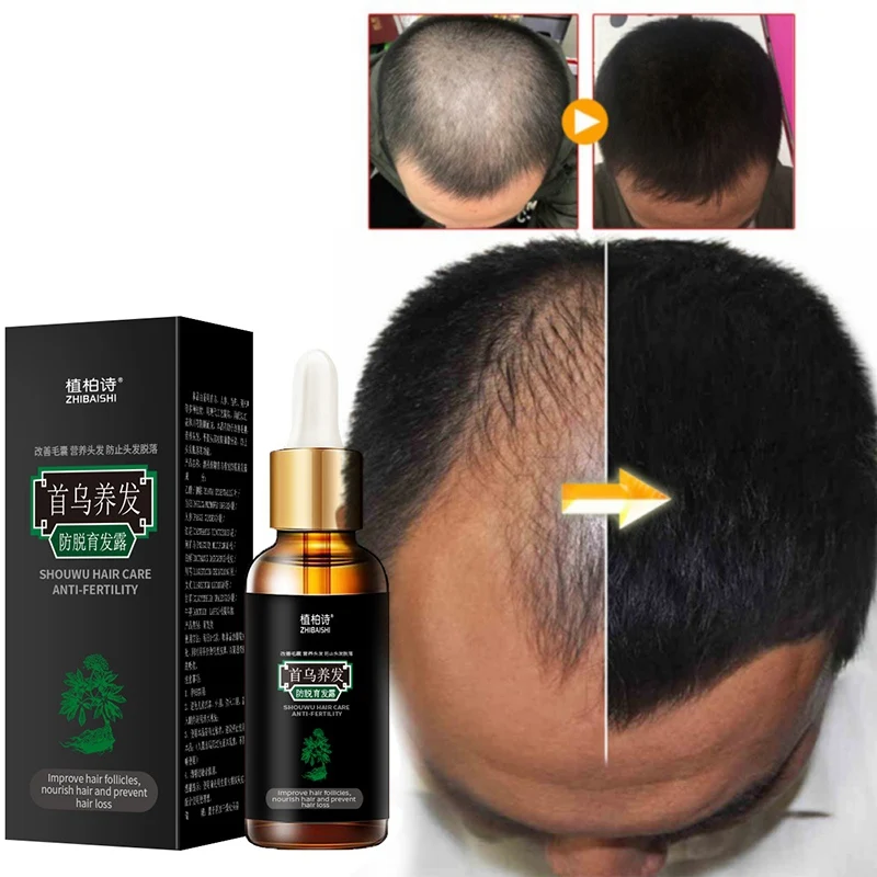 7 дней роста волос Эфирные масла против выпадения Жидкая Сыворотка для густых