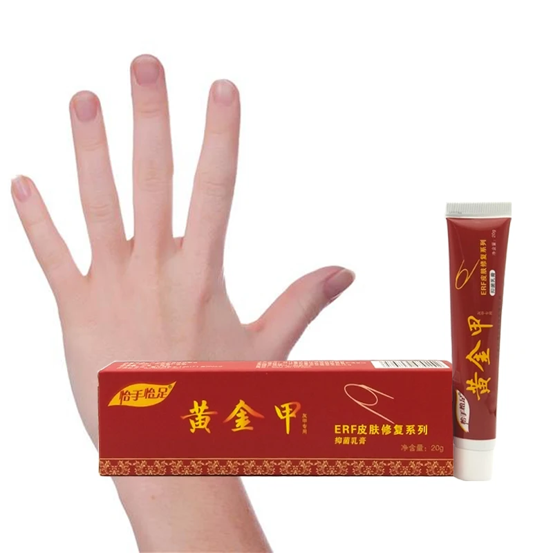 Китайская травяная мазь для лечения грибка ногтей | Красота и здоровье