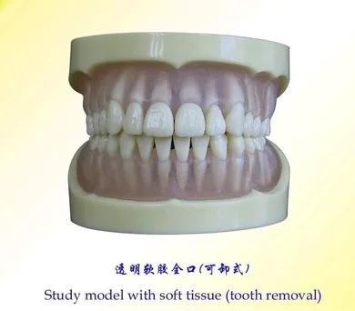 

Removable Transparent Oral Dental model free shipping