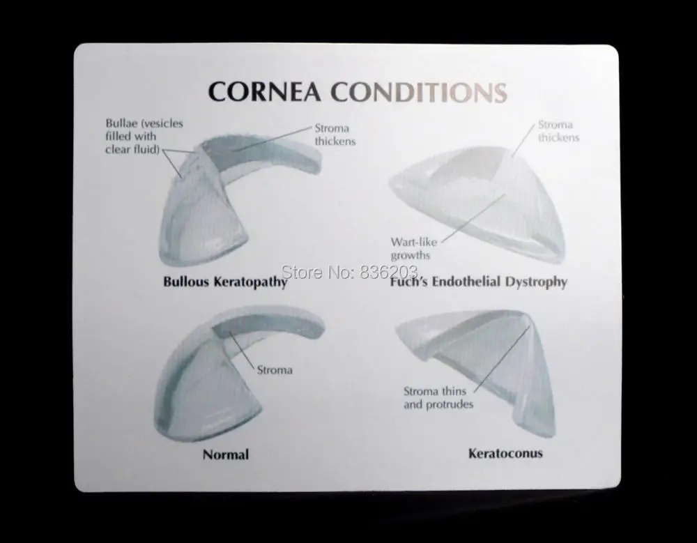 Человеческая анатомическая Роговица поперечное отверстие глаз модель в травмах