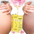40 г для похудения средство для борьбы с целлюлитом крем сжигатель жира потеря веса, похудения кремы ноги средства ухода за Целлюлит Жир сжигание