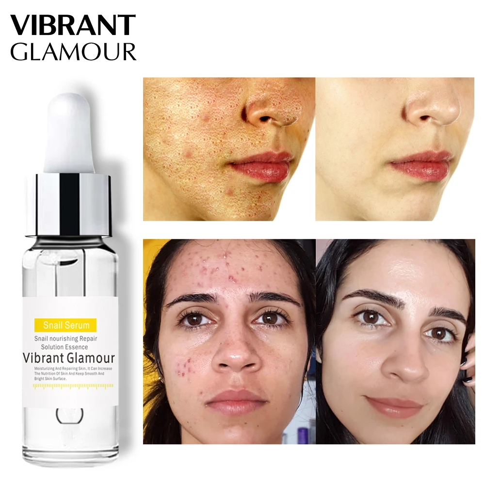 Улитка 100% растительный экстракт жидкая Гиалуроновая кислота отбеливание пятна