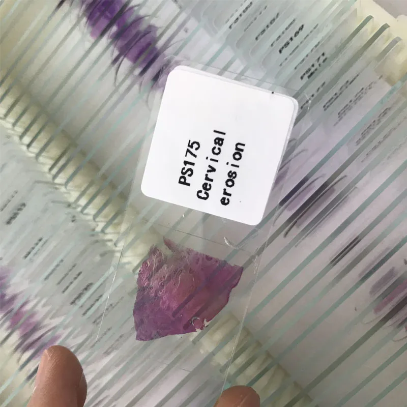 200 шт. подготовленные слайды для патологии человека|Образовательное