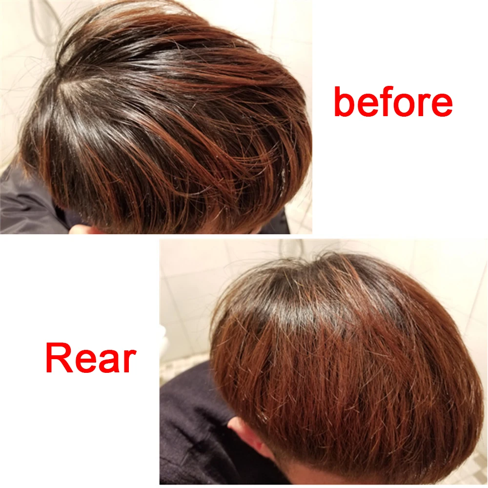 Быстросохнущая жирная пудра для волос мгновенная фиксация жирных с чистящей