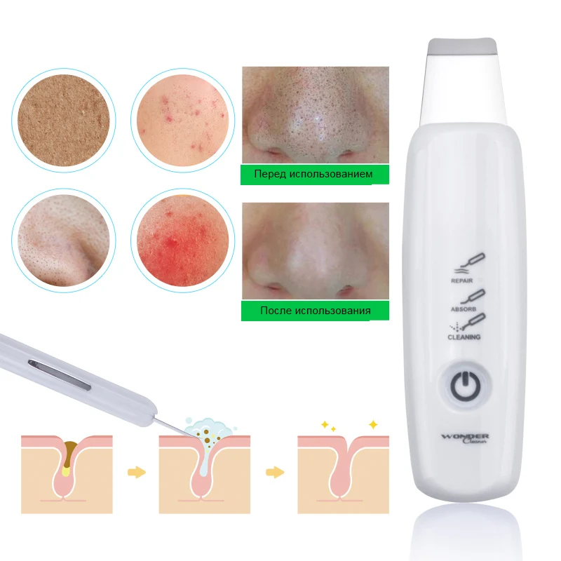 Ультразвуковая щетка для кожи удаление угрей лица Глубокая чистка пилинг