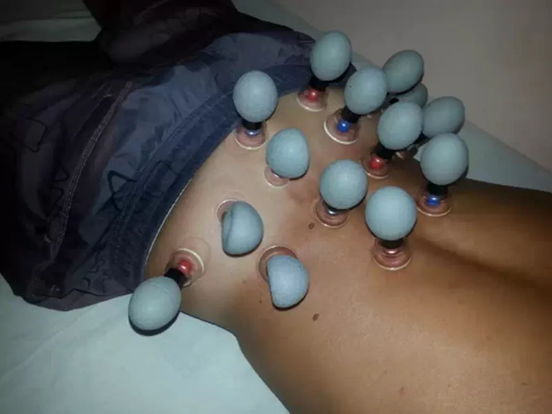 8, 12, 18 шт., Набор вакуумных банок для магнитотерапии, Акупрессура, присоска, TCM, акупунктура, прижигание, китайская медицина, массажные баночки
