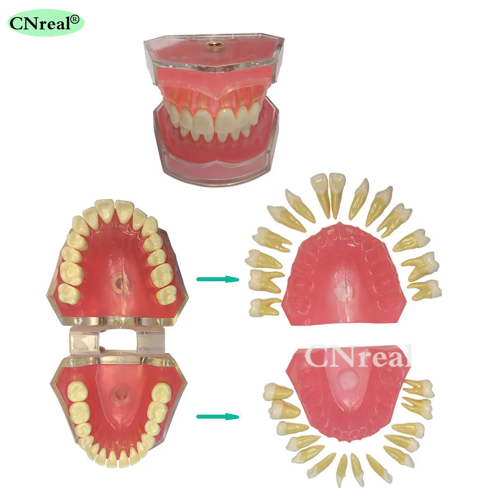 1 Piece Detachable Resin Teeth Model with Soft Silicone Gum for Teaching & Learning/Demo