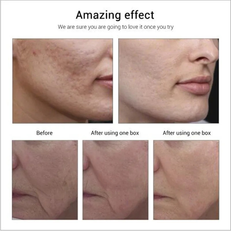 LANBENA Гиалуроновая кислота Сыворотка для лица с гиалуроновой кислотой Витамин Е