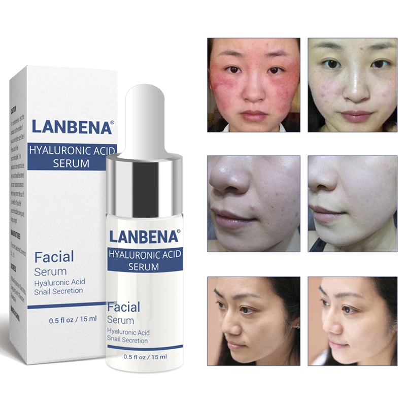 Сыворотка с гиалуроновой кислотой отбеливающая эссенция LANBENA Омолаживающий