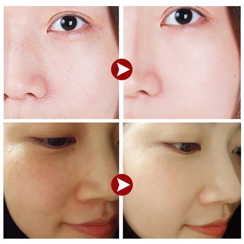 Увлажняющий ампул капсула LANBENA крем для лица сыворотка отбеливания кожи против