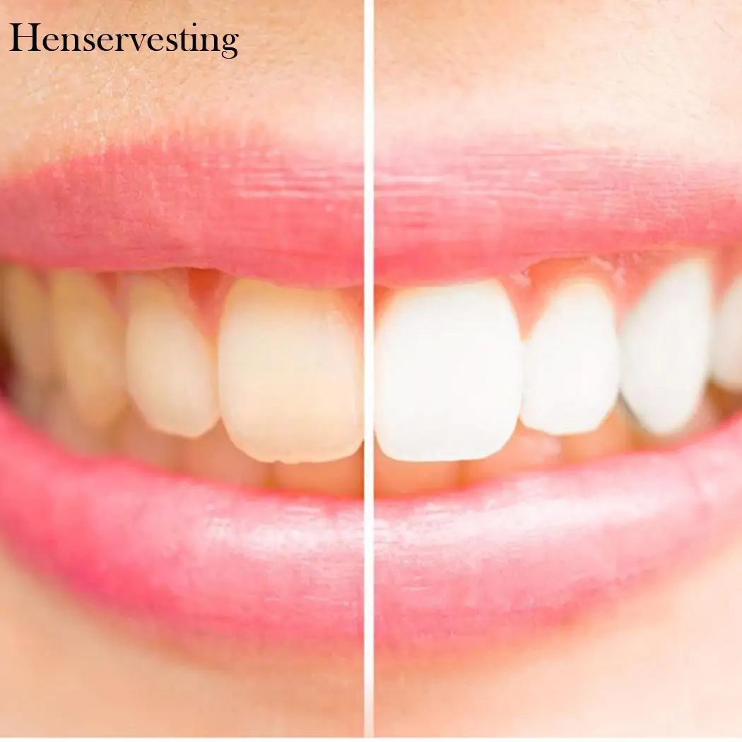 Зубы отбеливающая жидкость унисекс удалить чай пятно кофе уменьшить зуб грязи