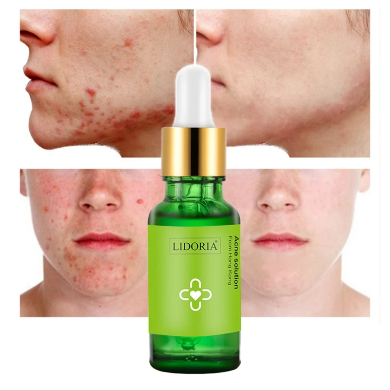 

20ml Face Serum Moisturizer Hydrating Remove Acne Shrinking Pores Face Serum Firming Skin Facial Accessory