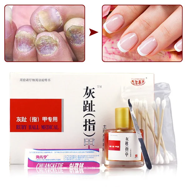 

Hot sale Nail Fungal Treatment Set Onychomycosis Removal Anti Fungus Toenail Nails Care Repair Liquid 25ml