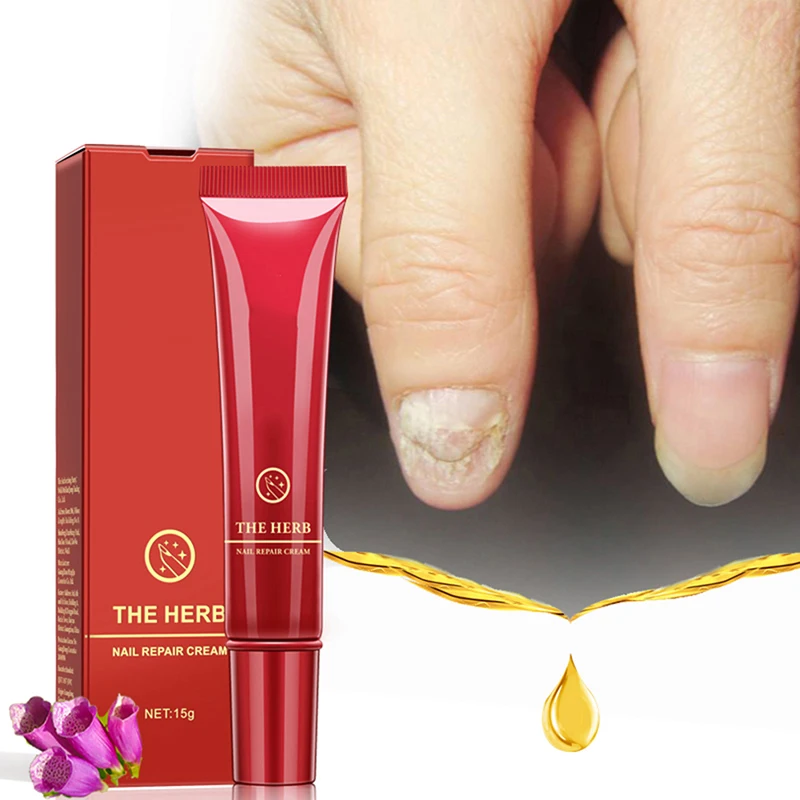 

Nail Care Tools 15g Nail Protector Skin Care Cream Nail Fungus Treatment Herb Nails Repair Cream