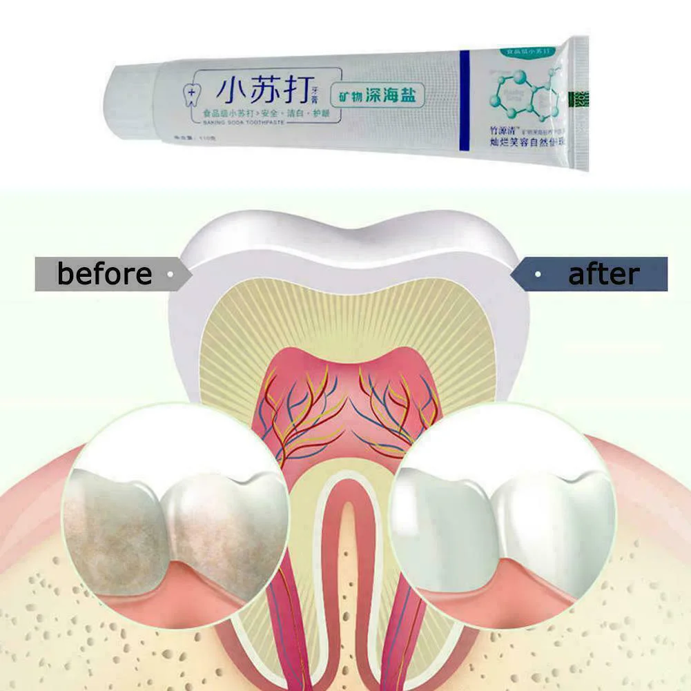 Protect Teeth Whiter Oral Hygiene Bad Breath Portable Fresh Stain Removal Gingiva Home Repair Dental Toothpaste Bleeding | Красота и