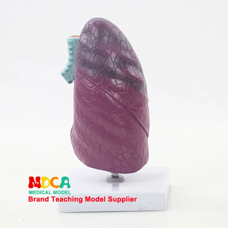 

MFB001 Medical Teaching of Pulmonary Structural Models in Respiratory Department of Pulmonary Anatomy
