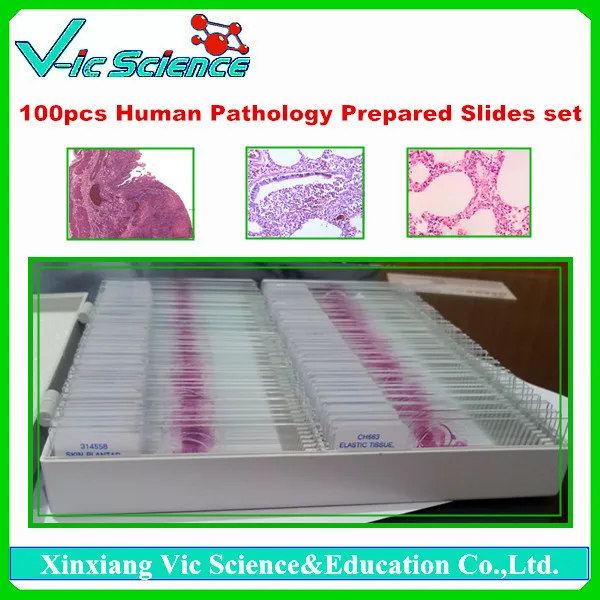 100 шт. набор слайдов для патологии человека|pathology slides|setset 10 |
