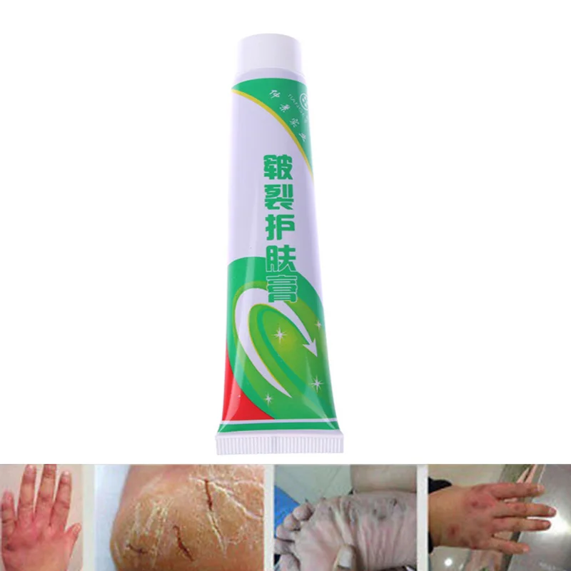 

Hot Sale Powerful Hand Foot Crack Cream Heel Heel Chapped Peeling Foot and hand Repair Anti Dry Crack Skin Care Chinese Ointment