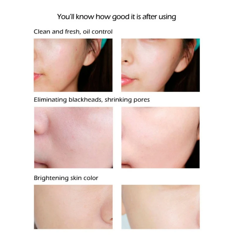 Средство для удаления угрей Ecophy Seven китайская медицина белое мыло лица Очищение