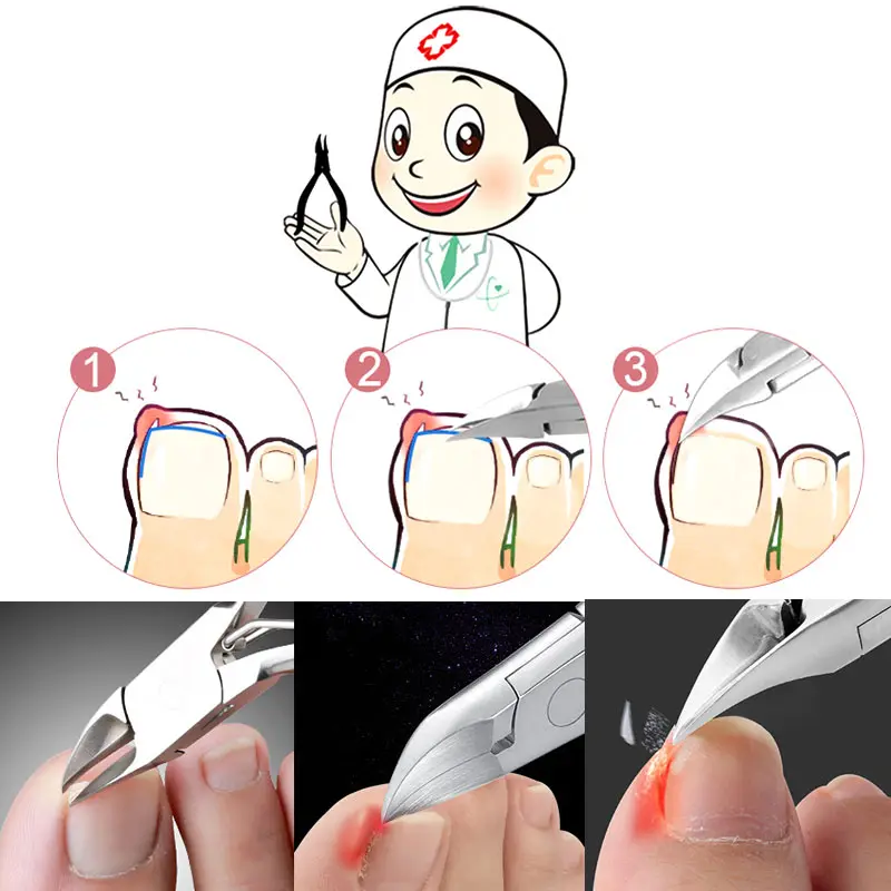 Машинка для стрижки ногтей на пальцах и носках из нержавеющей стали педикюрные