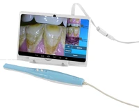 new cf 688a intra oral camera with usb otg dental camera for android phone and android tablet medical equipment
