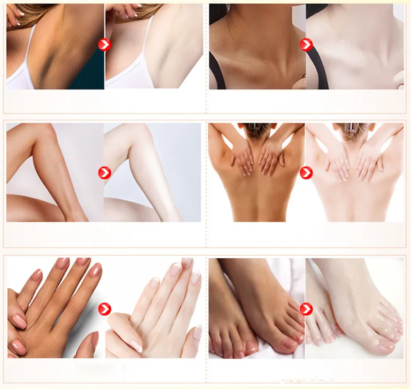 Aichun Beauty отбеливающий крем для подмышек Отбеливание подмышки ног коленей Частные
