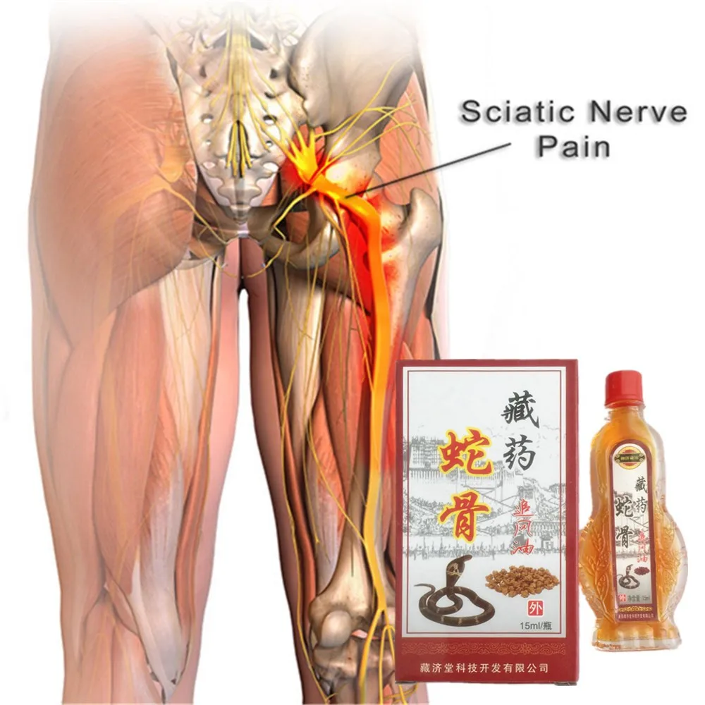 15m King cobra venom Sciatica Обезболивание облегчение гиперостеогенное Лечение Эфирное