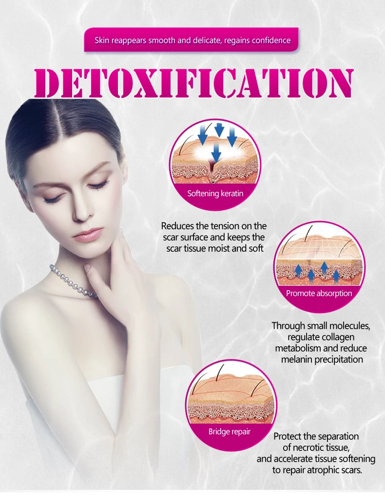 15 г ожоги от черных точек прыщей лечение хирургическое шрамов растяжек