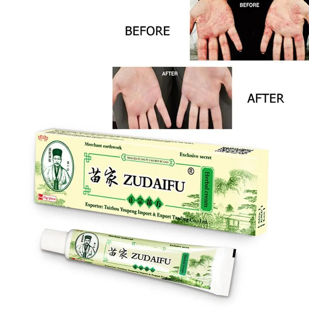 

1Pcs Zudaifu Psoriasis Skin Dermatitis Eczematoid Eczema Ointment Treatment Care Cream