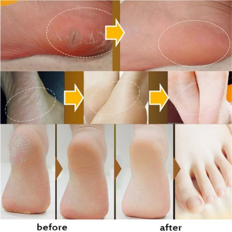 30 г полезный крем для кожи ног с конским маслом увлажняющий восстановления