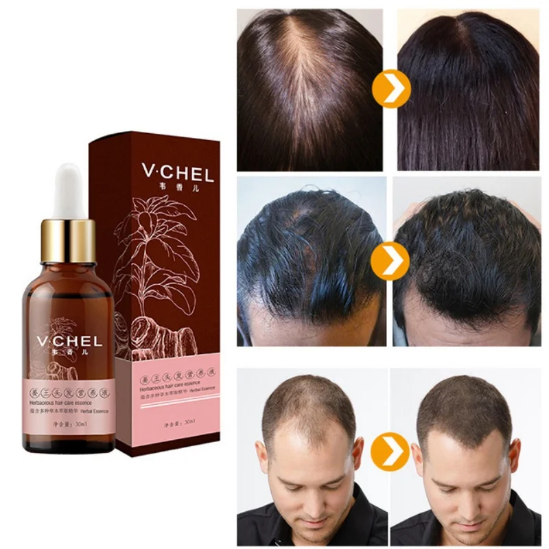 

7 Days Hair Growth Essential Oil Hairs Care Oil Ginger Essence Hairdressing Anti-hair Loss Dry Damaged Hair Nutrition