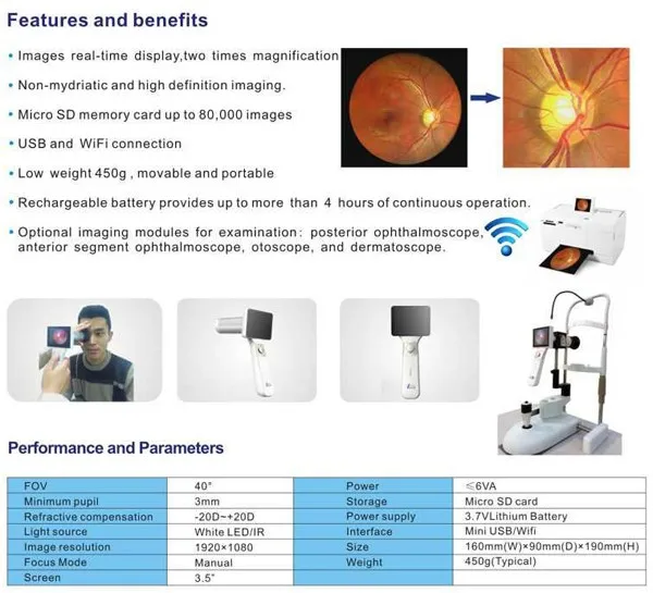 Портативный Non Mydriatic Fundus камера сетчатки с FDA для США
