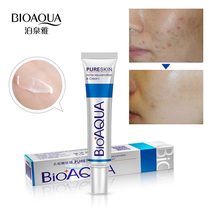 

Крем BIOAQUA для лечения акне, сужение пор, контроль жирности кожи, уход за кожей, 2 шт., 60 г