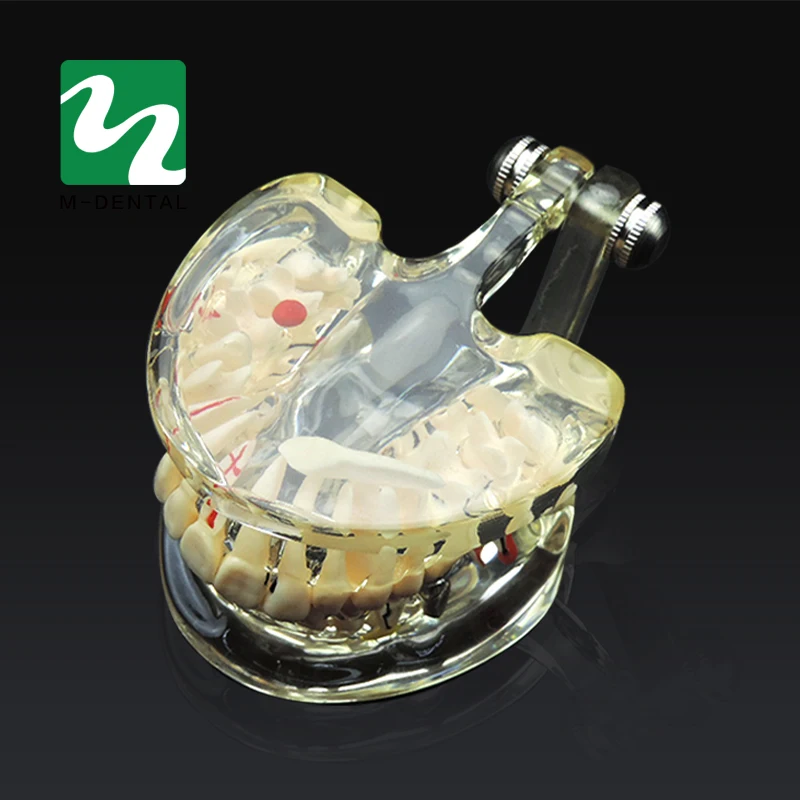 Модель зубов для обучения патологии и заболеваниям взрослых модель съемная